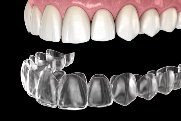 Invisalign braces or invisible retainer.